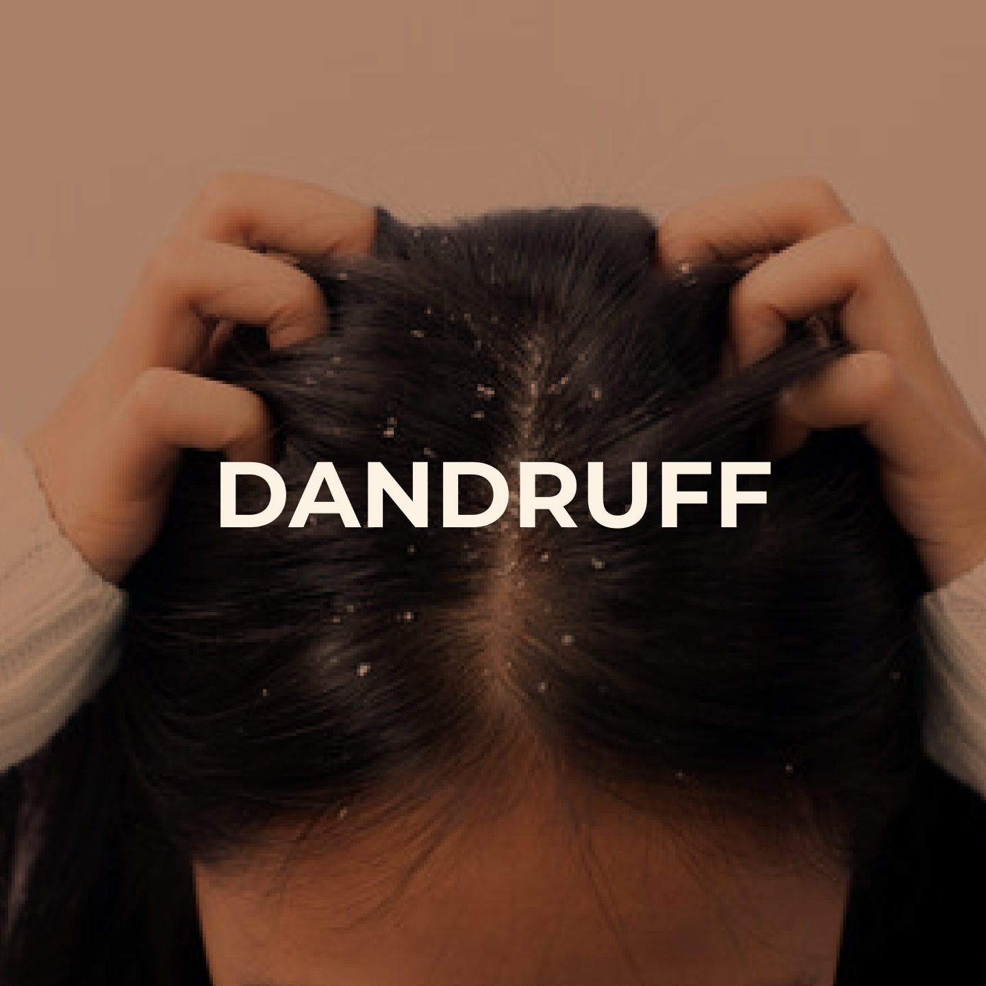 Dandruff