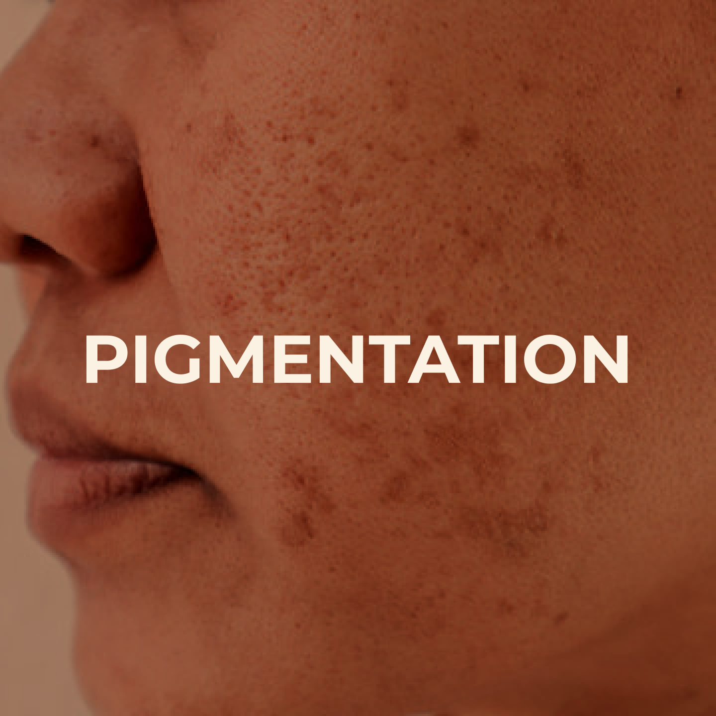 Pigmentation